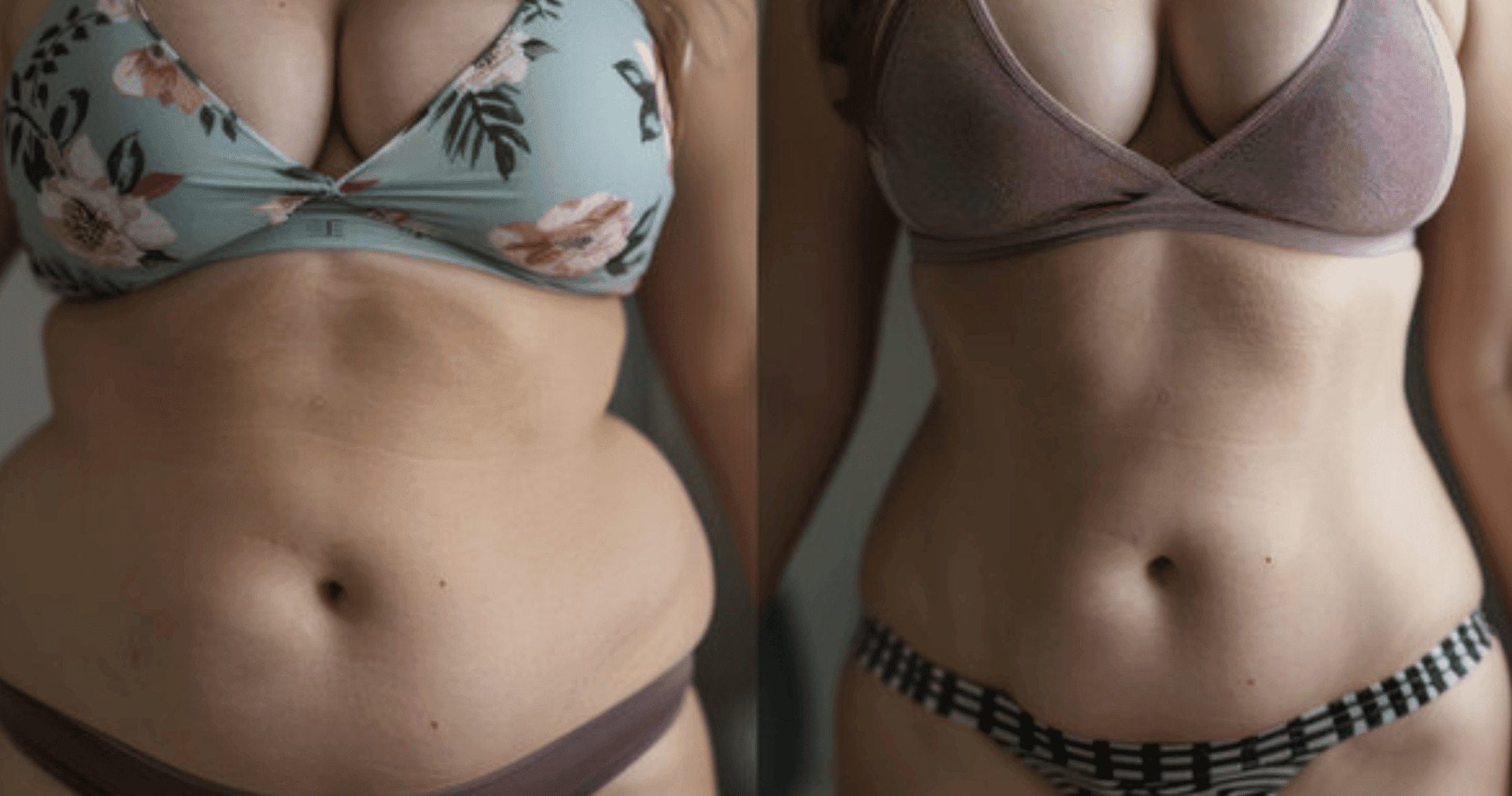 GLP-1 Medical Weight Loss in Tigard, OR