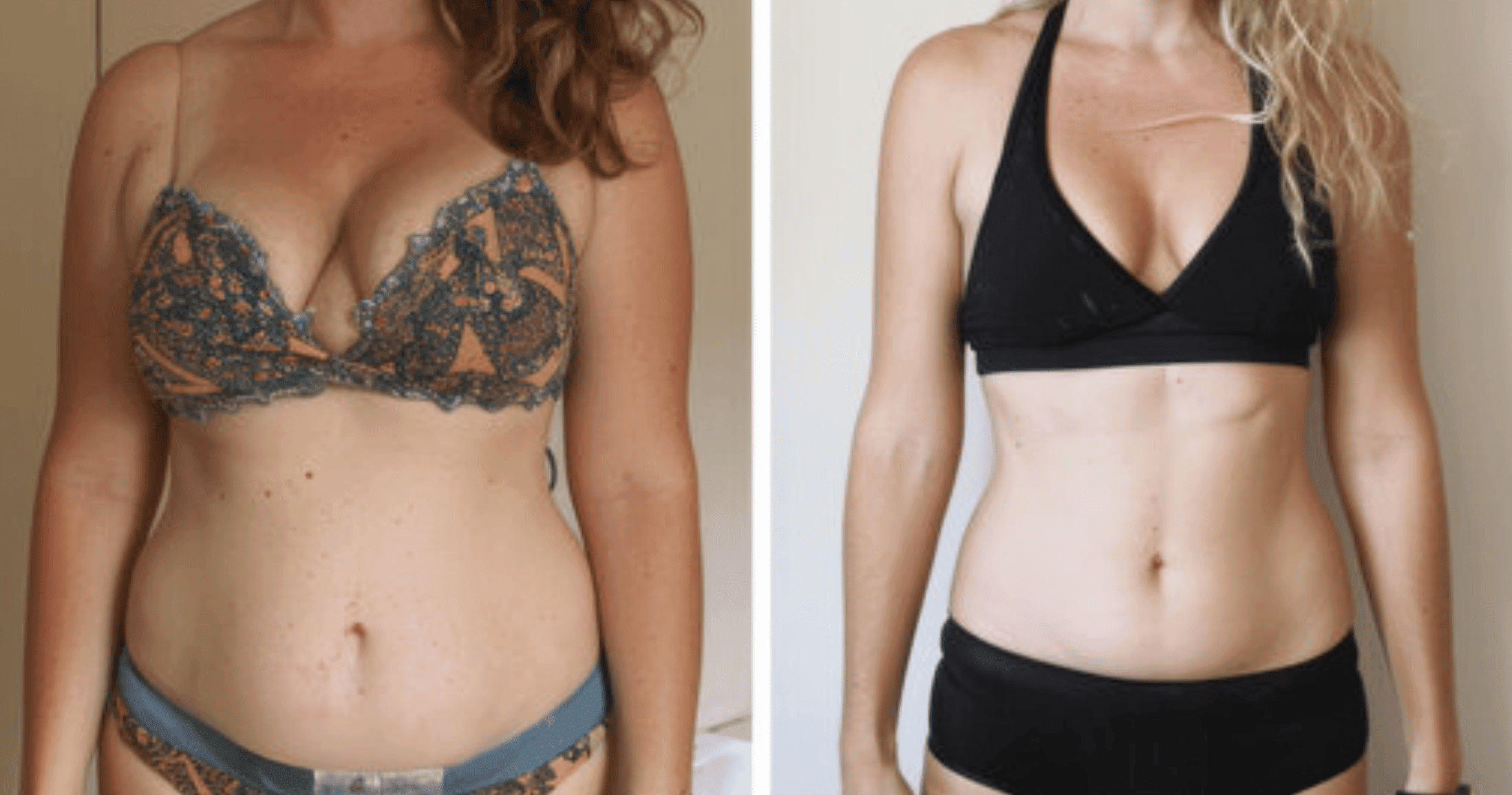 GLP-1 Medical Weight Loss in Tigard, OR